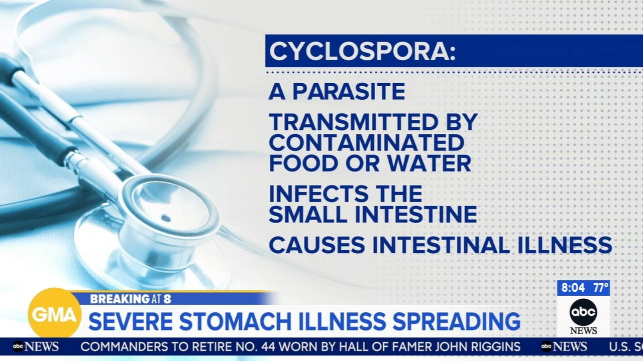Cyclosporiasis symptoms, treatment and how it's spread: Everything to know about the intestinal parasitic disease