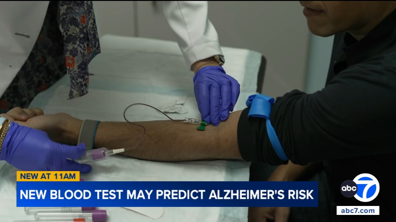 Study shows a blood test can help identify healthy people at high risk for Alzheimer's disease